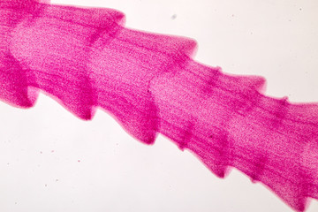 Patterns and backgrounds of Parasitic, Study for Anatomical pathology in laboratory.