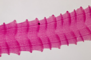 Patterns and backgrounds of Parasitic, Study for Anatomical pathology in laboratory.