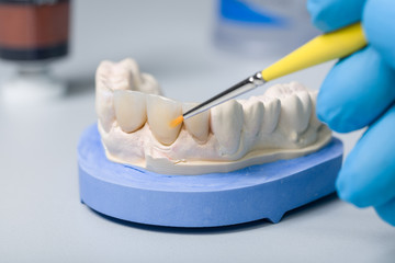 Farbliche Bearbeitung eines Zahnersatzes im Dentallabor