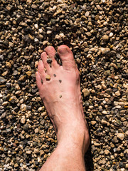 View of the foot of a man who is covered with stones and sand on the beach