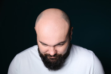 Man with hair loss problem on dark background