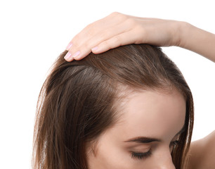 Woman with hair loss problem on white background, closeup