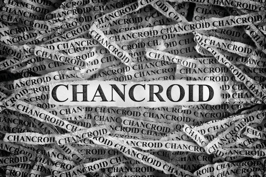 Torn pieces of paper with the words Chancroid