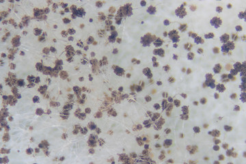Rhizopus (bread mold) is a genus of common saprophytic fungi,Rhizopus (bread mold) under the microscope.