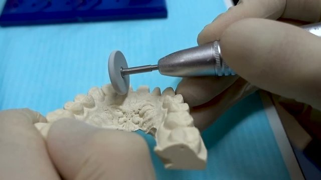 Dental technician is making teeth implats. Close hands. Dental laboratory tooth preparation. 