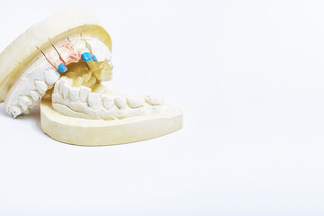 Plaster cast of teeth with space for your texts