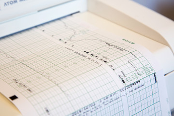 出産直前の心電図