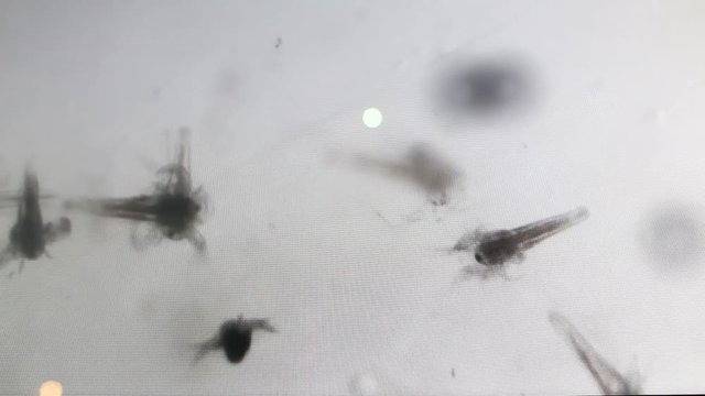 Microorganisms moving under powerful Microscope