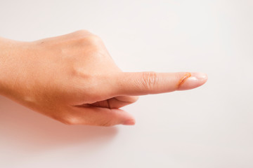 The lesion from cut by a knife at index finger.