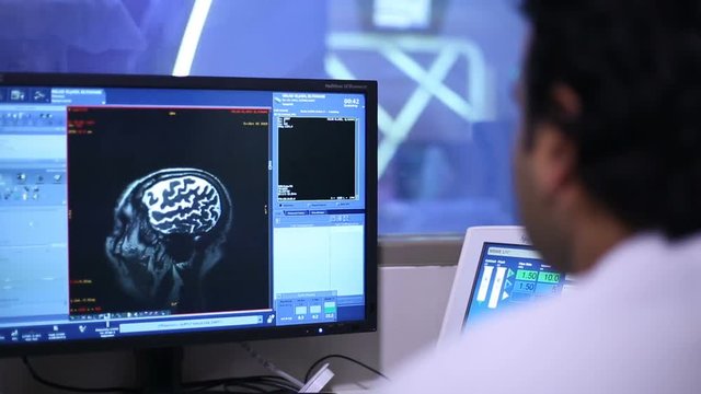 Brain imaging. Pictures of the brain scan on the monitor. MRI research.