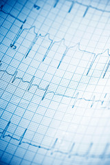 Electrocardiogram close up