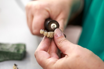 Dental technician working on a metallic prosthesis