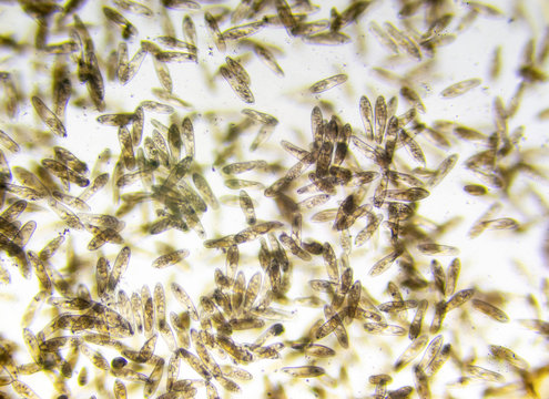 Microscope image footage of protozoa microorganisms in water, showing ciliates, paramecium, bacteria spirochaete and algae.