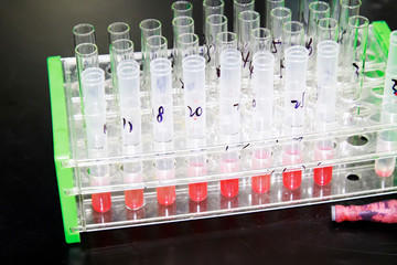 serum samples in the test tube