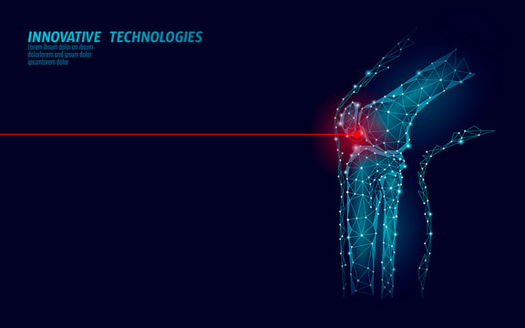 Human Knee Joint 3d Model Vector Illustration. Low Poly Design Future Technology Cure Pain Treatment. Blue Background And Red Injury Man Body Leg Medicine Template