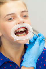 girl with braces at the reception at the dentist. Close-up. Hand in glove with a tool at the...