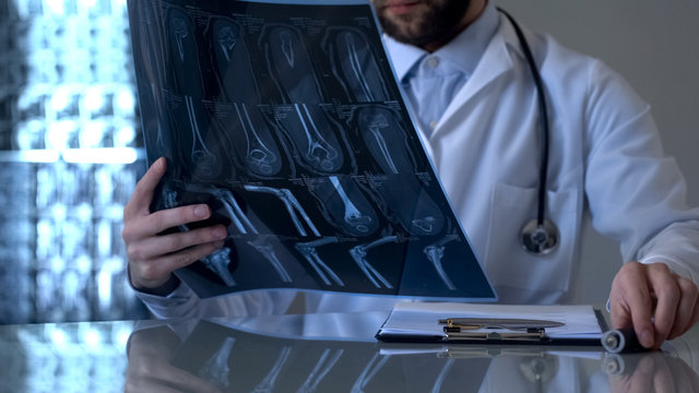 Male traumatologist looking at patient leg x-ray, diagnostic health problem
