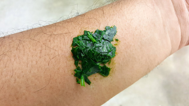 close-up centipede bite, poisonous hurt arm cure with herbal medicine in thailand