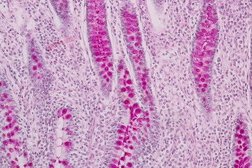 Tissue of small intestine or small bowel under the microscopic in Lab.