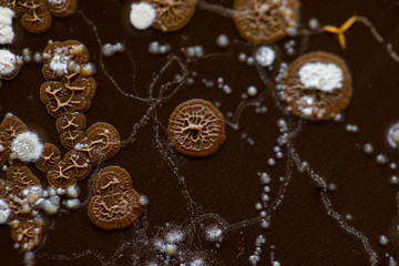 Colony characteristic of Actinomyces, Bacteria, yeast and Mold on selective media from soil samples for study in laboratory microbiology.