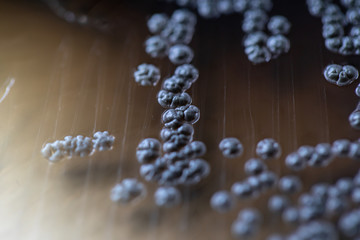 Colony characteristic of Actinomyces, Bacteria, yeast and Mold on selective media from soil samples for study in laboratory microbiology.