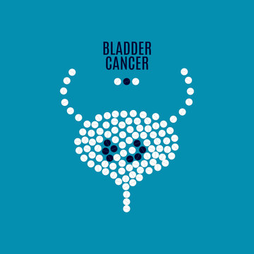 Bladder Cancer Awareness Vector Poster With Bladder Made Of Pills On Blue Background. Medical Solidarity Concept For Clinics. Human Body Organ Anatomy Icon.