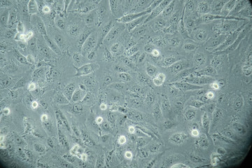 Microscope observation of human cells