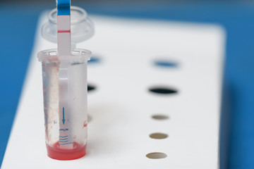 Express used HIV test using blood from a finger macro