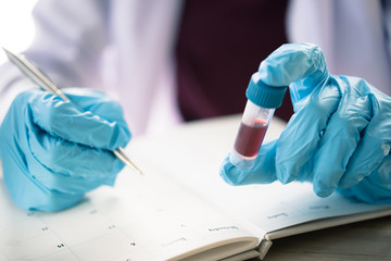 technician of health with blood tubes in the clinical lab for analytical , hand of doctor holding blood sample in tube test and she is Taking notes.