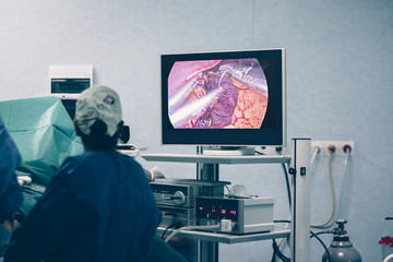 Bariatric weight loss surgery with a gastric band or through removal of a portion of the stomach or gastric bypass surgery with endoscopy and laparoscopic gastric sleeve surgery - obrazy, fototapety, plakaty