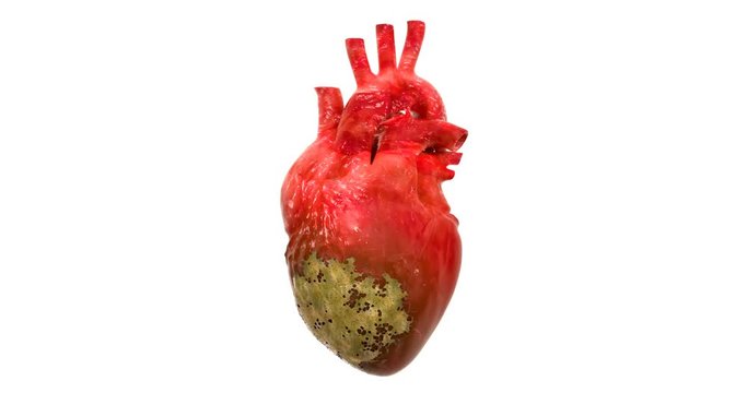 Disease spread on heart, 3d animation. 3D rendering isolated on white background