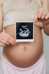photo ultrasound in the hands of a pregnant girl on a belly background