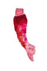 Patterns and backgrounds of Parasitic, Study of Parasitic and Anatomical pathology in laboratory.