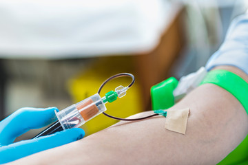 Platelet Rich Plasma Cosmetics Treatment, Drawing Blood