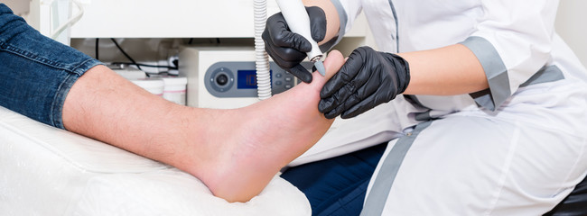 Podology treatment. Podiatrist treats foot. Podiatry doctor or dermatologist treats the patient in modern clinic - obrazy, fototapety, plakaty
