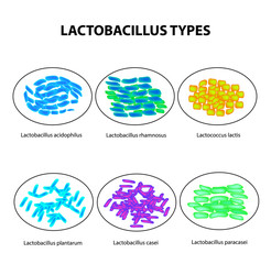 Types of lactobacilli. Lactobacillus. Good intestinal microflora. Infographics. set. Vector illustration on isolated background.