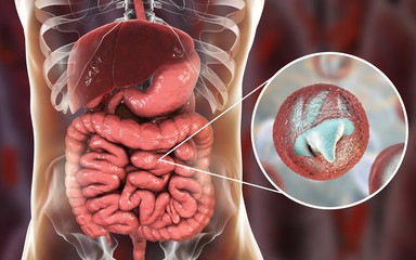 Cryptosporidiosis, a diarrheal disease caused by Cryptosporidium parvum protozoan. 3D illustration showing release of parasite sporozoites from oocyst inside small intestine - obrazy, fototapety, plakaty