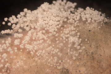 Backgrounds of Colony Characteristics of Rhizopus (bread mold) is a genus of common saprophytic fungi,Rhizopus (bread mold) under the microscope.