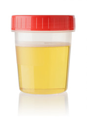 Urine sample in container isolated on white
