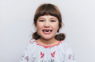 A little girl shows her milk teeth. Temporary baby teeth fall out. First-grader. Close-up.