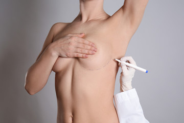 Doctor drawing marks on female breast before cosmetic surgery operation against grey background
