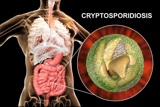 Cryptosporidiosis, a diarrheal disease caused by Cryptosporidium parvum protozoan. 3D illustration showing release of parasite sporozoites from oocyst inside small intestine