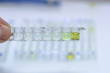 the doctor prepares and pours special solutions for the enzyme immunoassay of human blood for infections and hormones