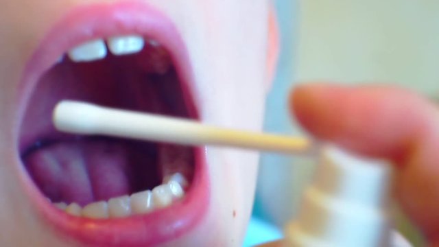 sore mouth and throat are treated with medication as a spray.close-up