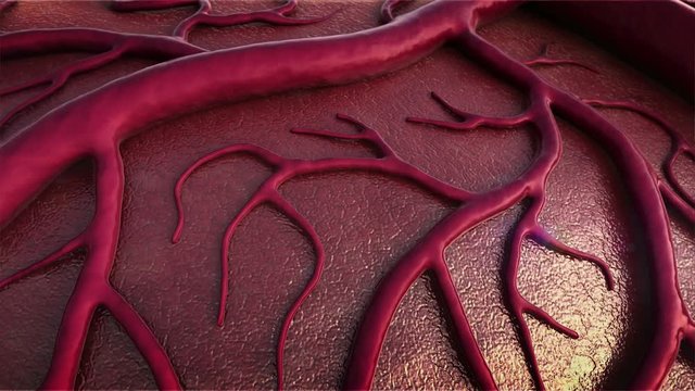 Brain Model, brain, brain surfase, insult, circulatory system, disease, heart attack, Capillary 