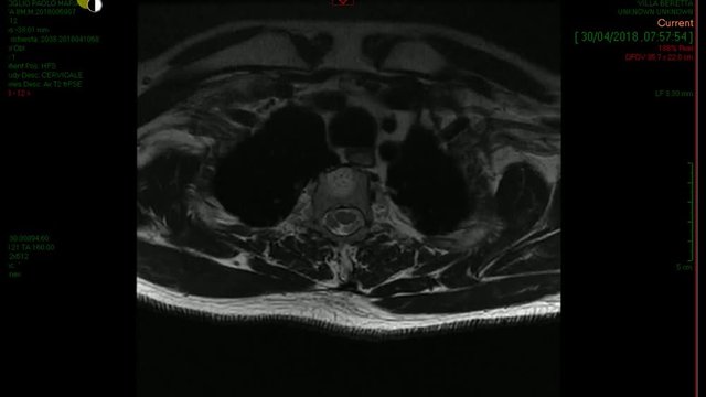Radiografia cervicale