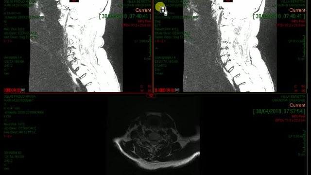 Radiografia