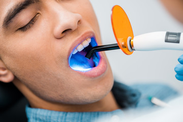 close up of african american man during whitening procedure