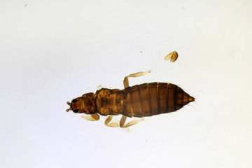 Cabbage thrips or Thrips angusticeps under the microscope
