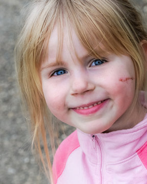 Portrait eines verletzten aber glücklichen Kindes - Werbebild für Versicherungen und Kinderärzte